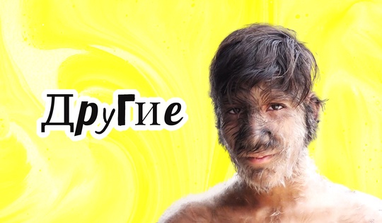 Истории людей с очень редкими генетическими заболеваниями 