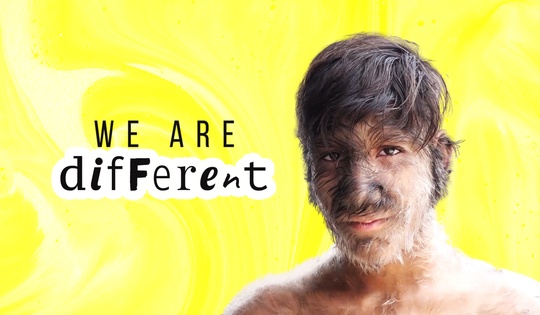 How do people with very rare genetic diseases live?