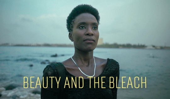 Skin-whitening trend ravages Senegalese women