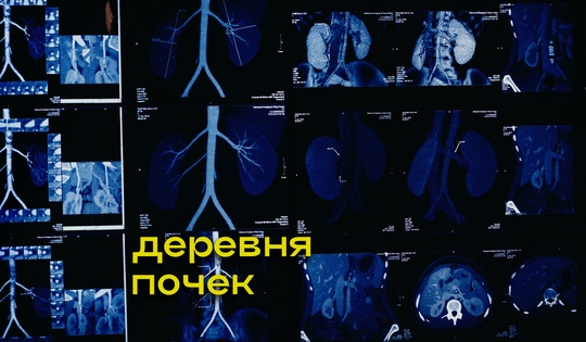 Как устроена массовая торговля органами в провинции Непала 
