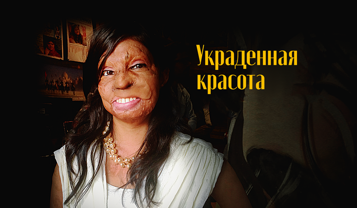 Как живут индийские девушки, которых облили кислотой 