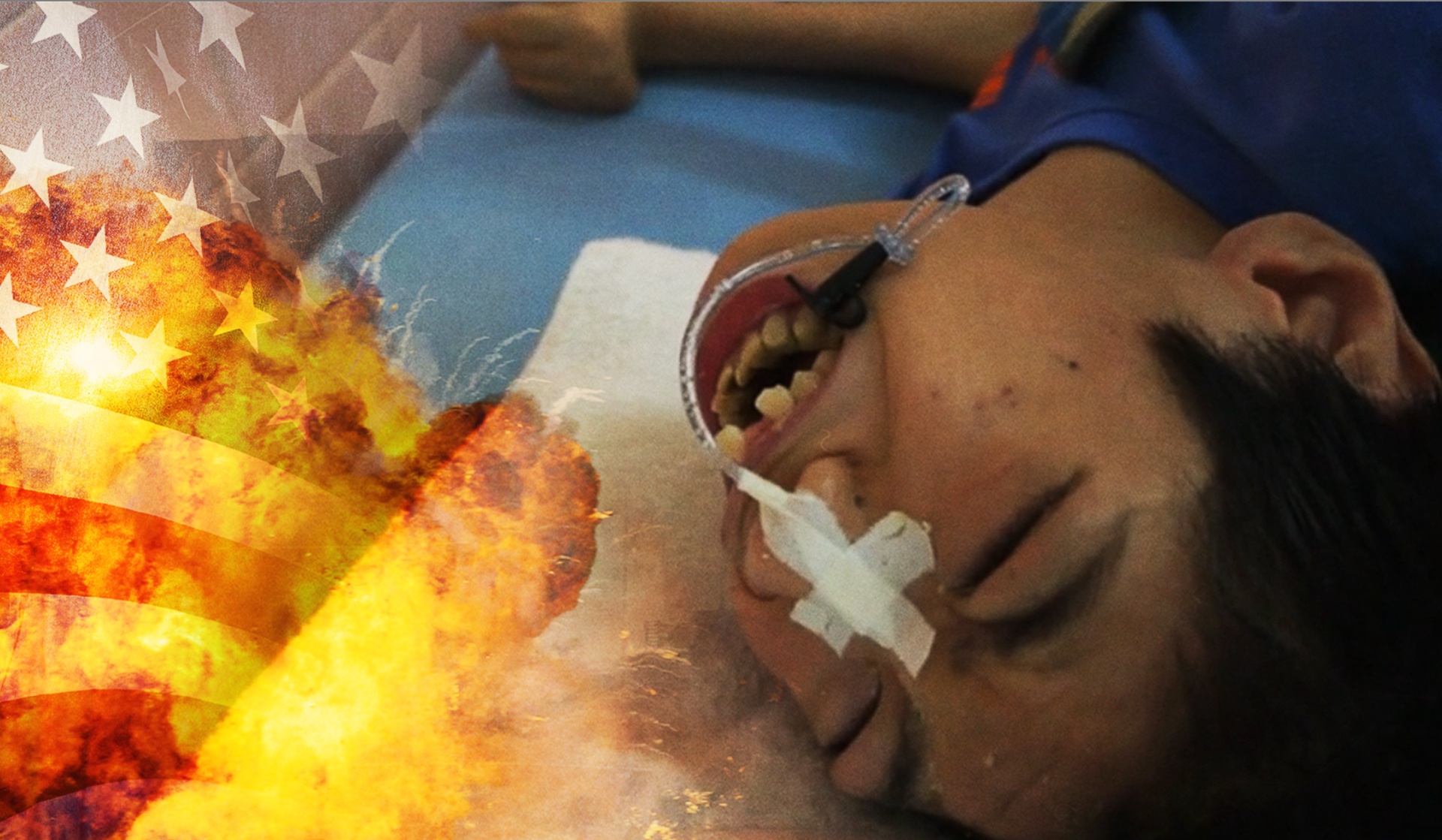 Vietnam: My Orange Pain