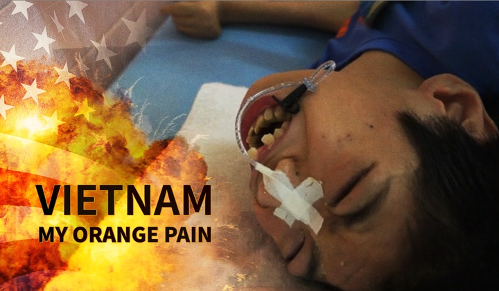Devastating consequences of the use of Agent Orange in the Vietnam War