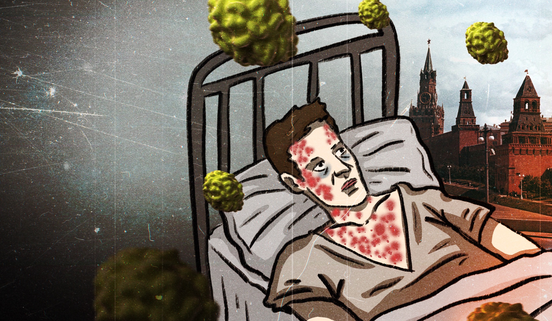 Smallpox Outbreak in Moscow