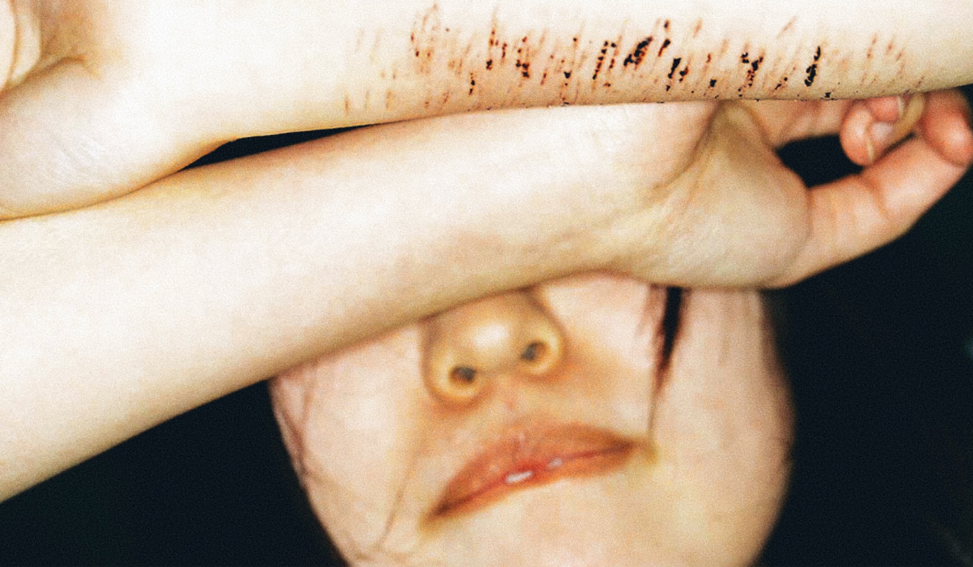 Self-Harm — the Pandemic of Youth